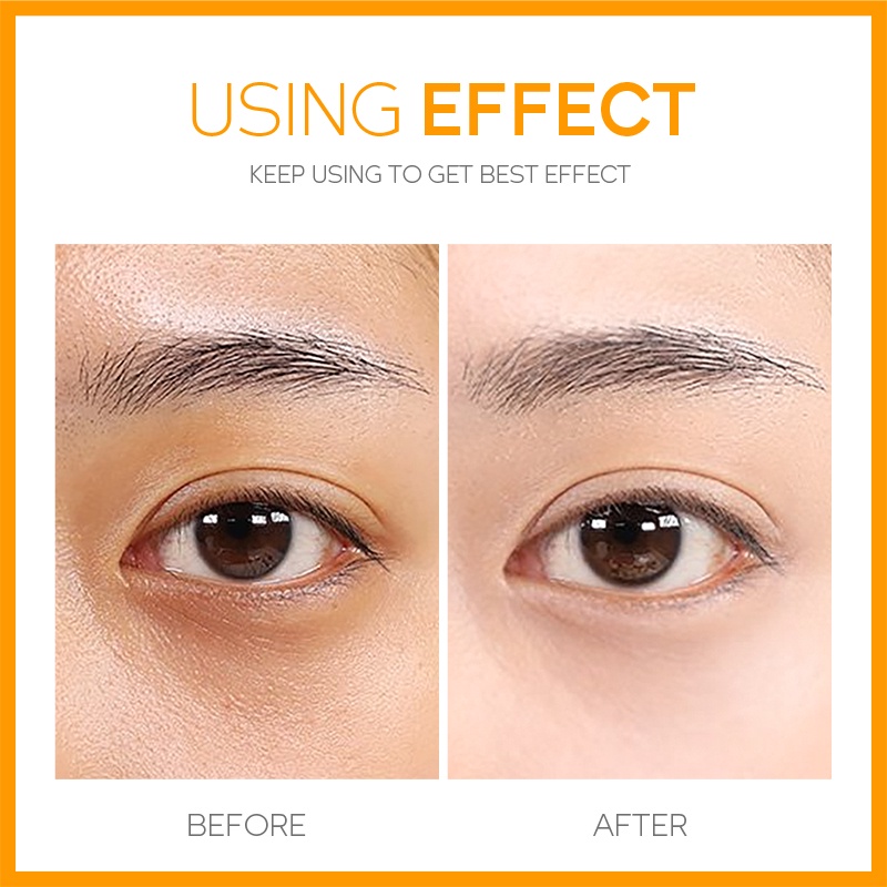 Fenyi Vitamin C Whitening Eye Cream (15 g)